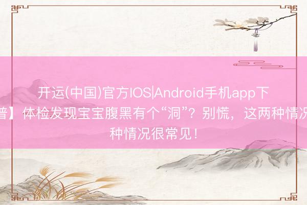 开运(中国)官方IOS|Android手机app下载 【科普】体检发现宝宝腹黑有个“洞”？别慌，这两种情况很常见！